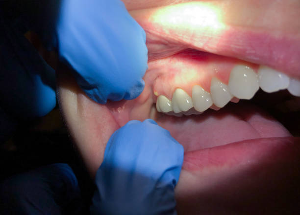 Best Urgent Tooth Repair  in Orrville, OH