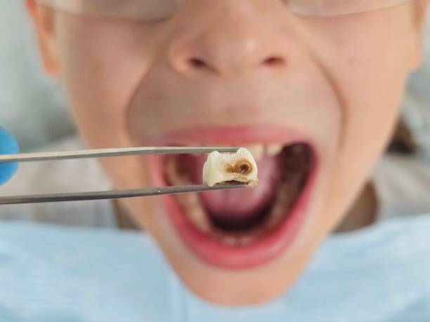 Best Cracked Tooth Emergency Dentist  in Orrville, OH