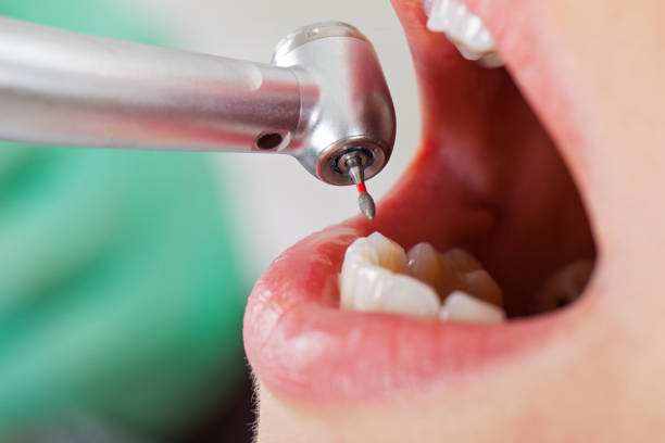 Best Root Canal Emergency Dentist  in Orrville, OH